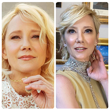 Anne Heche in Stable condition after car accident in Los Angeles Pakistani Sale